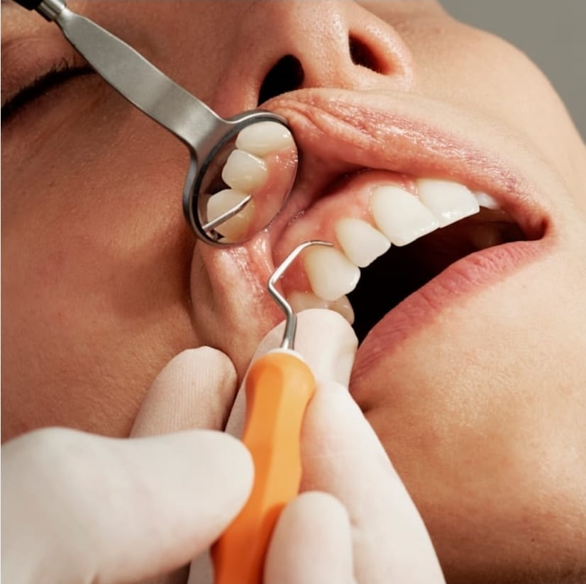 Dentalhygiene: professionelle Zahnkontrolle